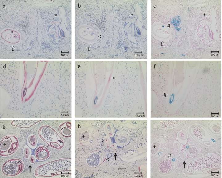 Fig 2. Histological analysis of endobacteria content and worm age.