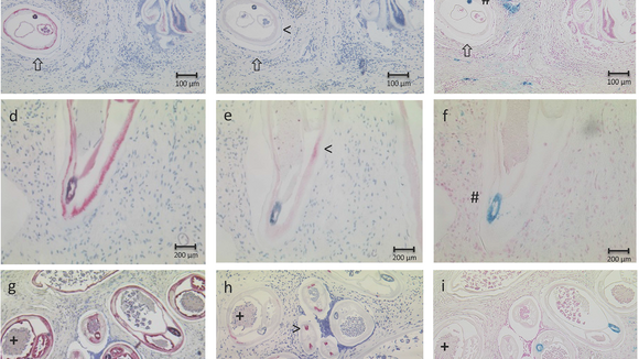 Fig 2. Histological analysis of endobacteria content and worm age.